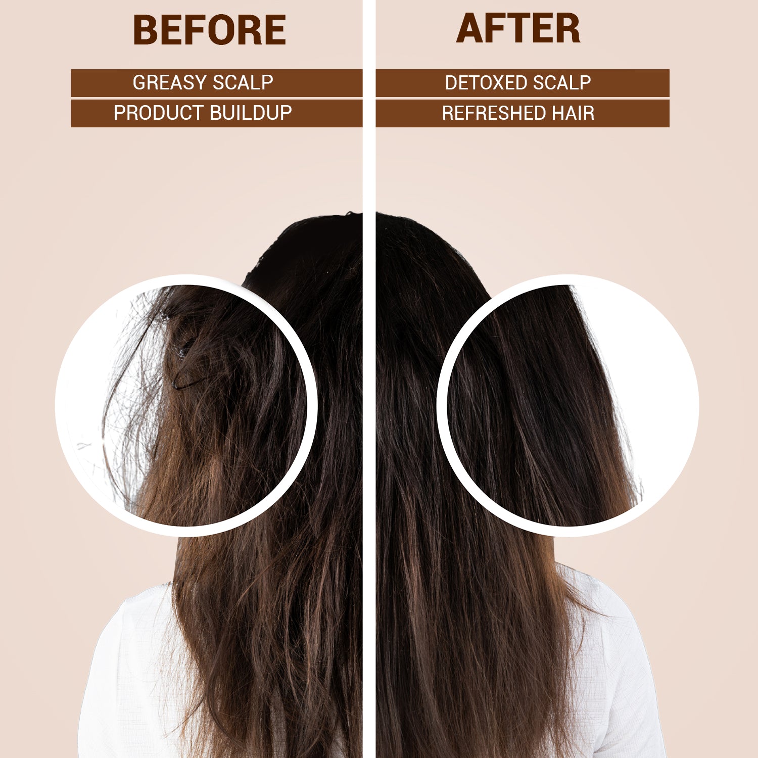 Detox & Refresh Shampoo | Infused with Avocado & Tea Tree Oil | Purifies Scalp & Controls Oil | For Chemically Damaged Hair | Sulfate-Free, Paraben-Free | 250ml